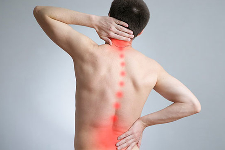 Which Physiotherapy Treatment Is Right for Muscle Pain: Cupping, MFR or Dry Needling? | Dr. Sumitz Clinic