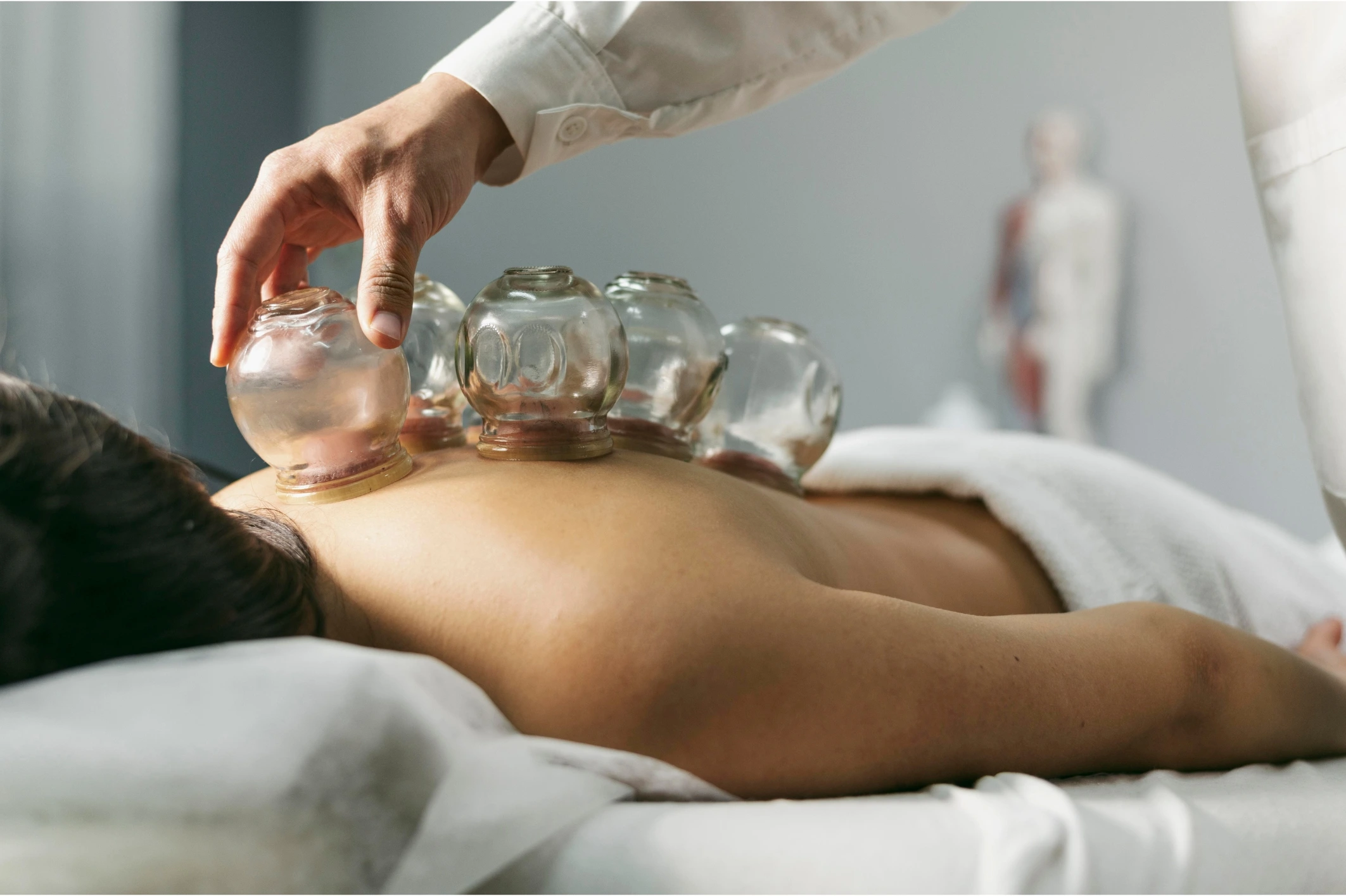 Best Cupping Therapy in Baner Pune for Muscle Pain Relief &ndash; Dr SumitZ Physiotherapy Clinic